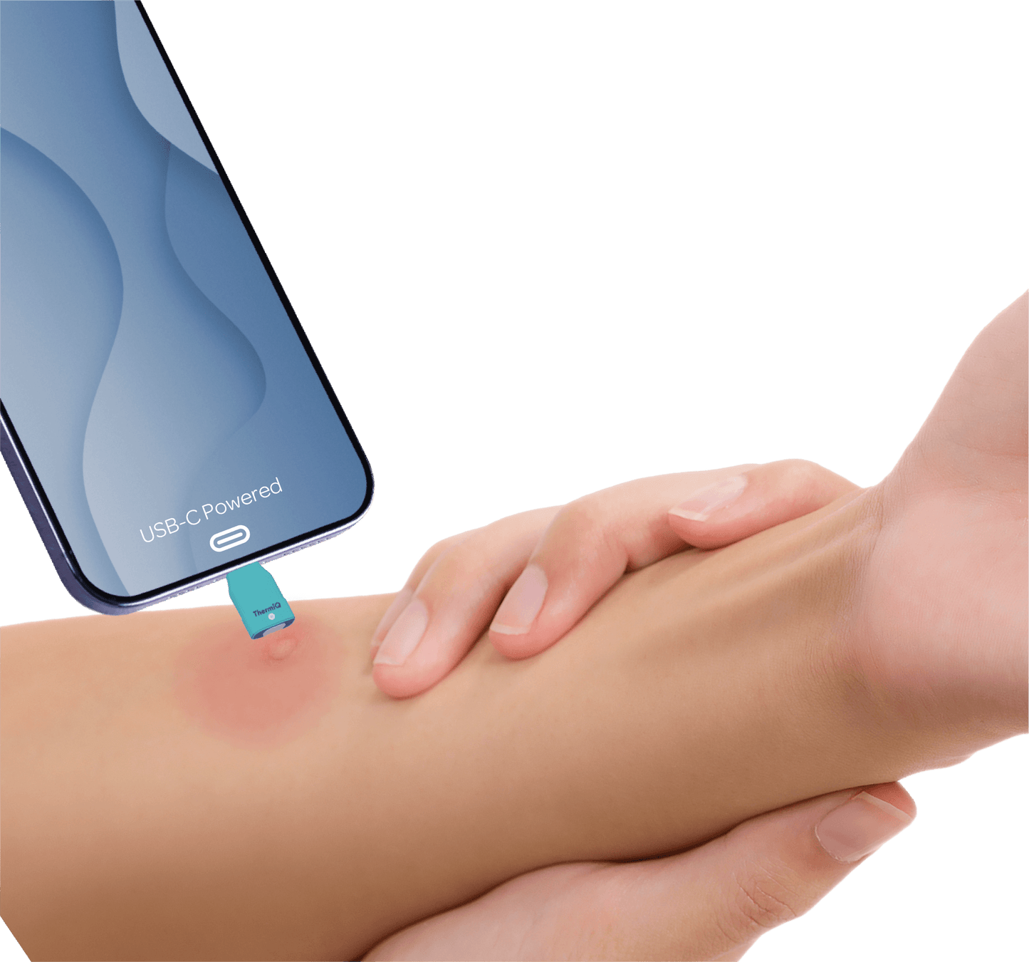 ThermiQ Insect Bite Healer