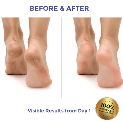 Diamond Luxe Heel Balm for Dry & Cracked Heels